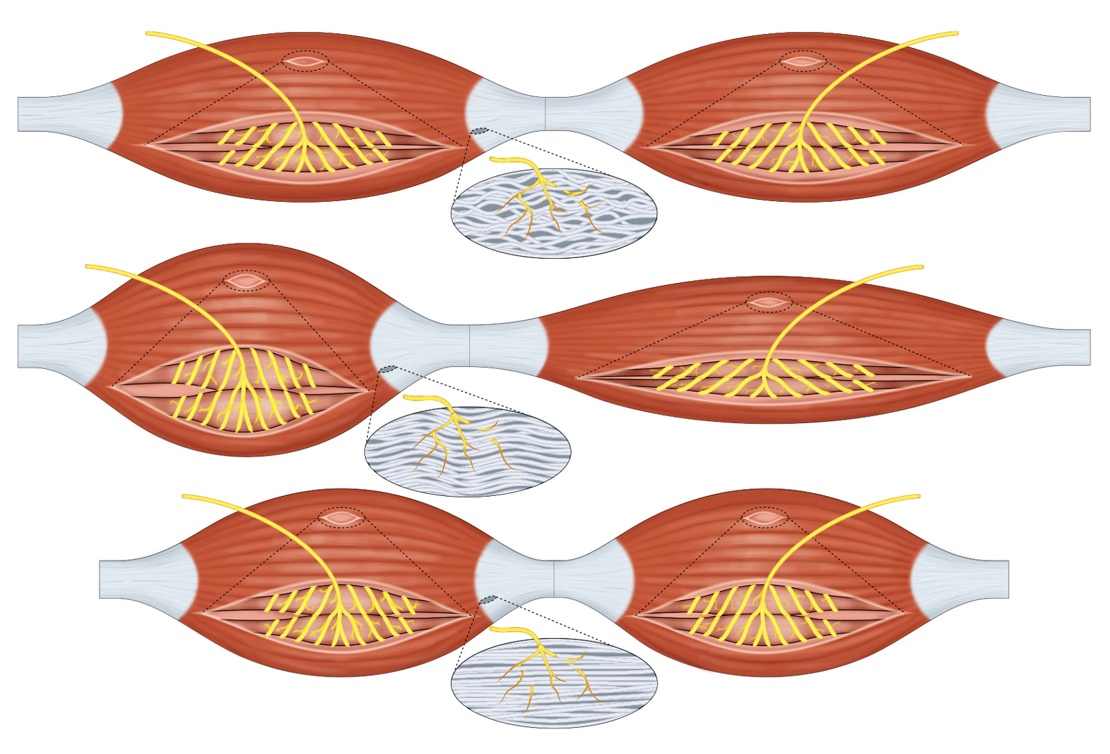 AMI Golgi tendon organ